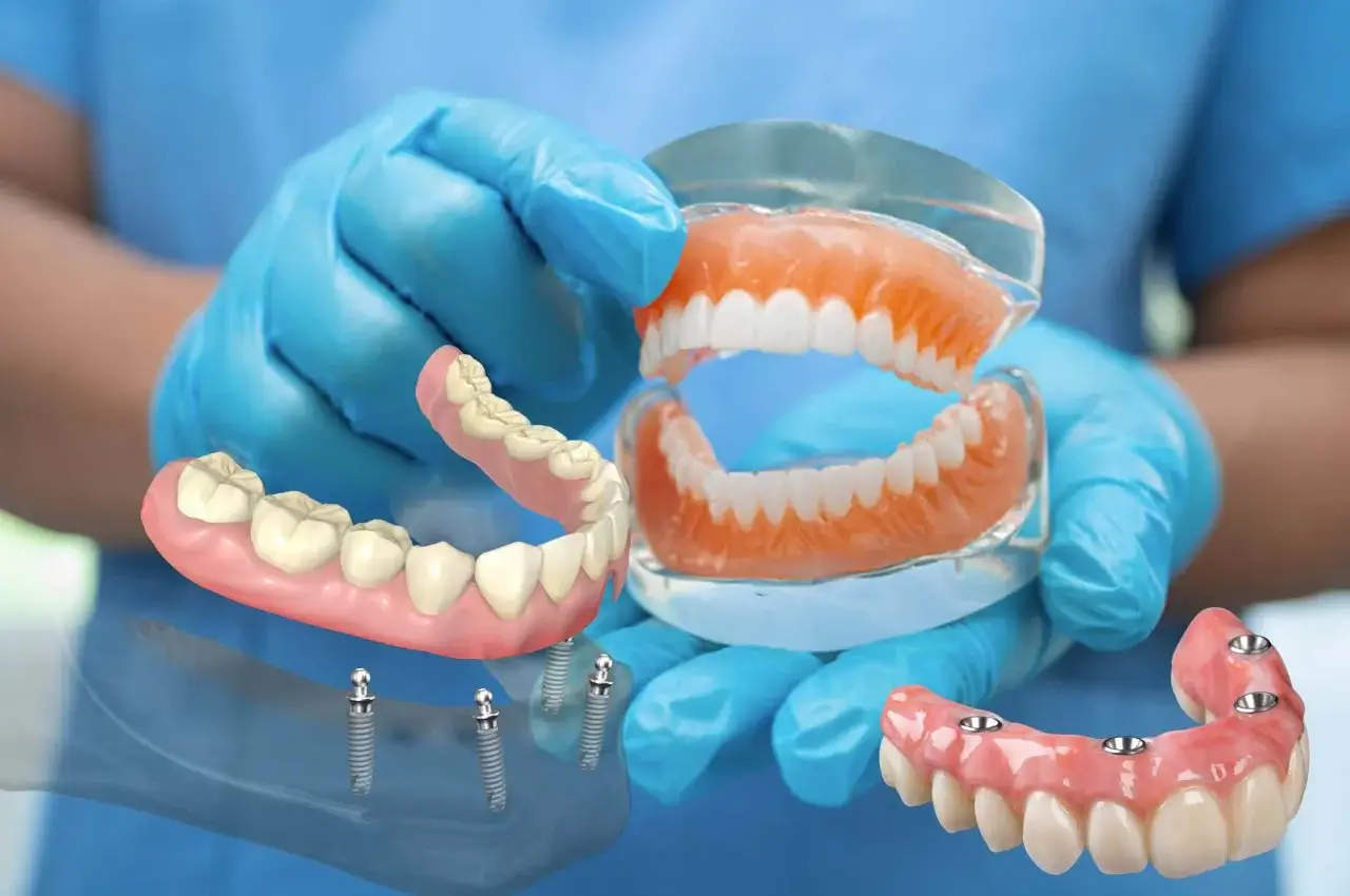 Diş Protezi Nedir? Türleri Nelerdir? Kimler İçin Uygundur?