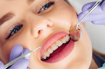 Diş Teli Tedavisi: Süreç ve Beklentiler