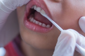 Kalıcı Ön Dişlerin Çıkmaması: Sorun ve Çözümleri